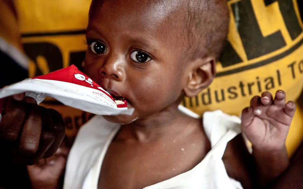 Hungersnot Afrika verhindern: Der elf Monate alte Johannes in Ostafrika erhält Erdnusspaste gegen Unterernährung. 