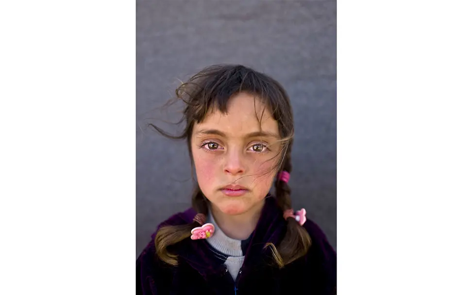 Syrien: Das Gesicht einer geschundenen Kindheit. © Muhammed Muheisen/AP/dpa
