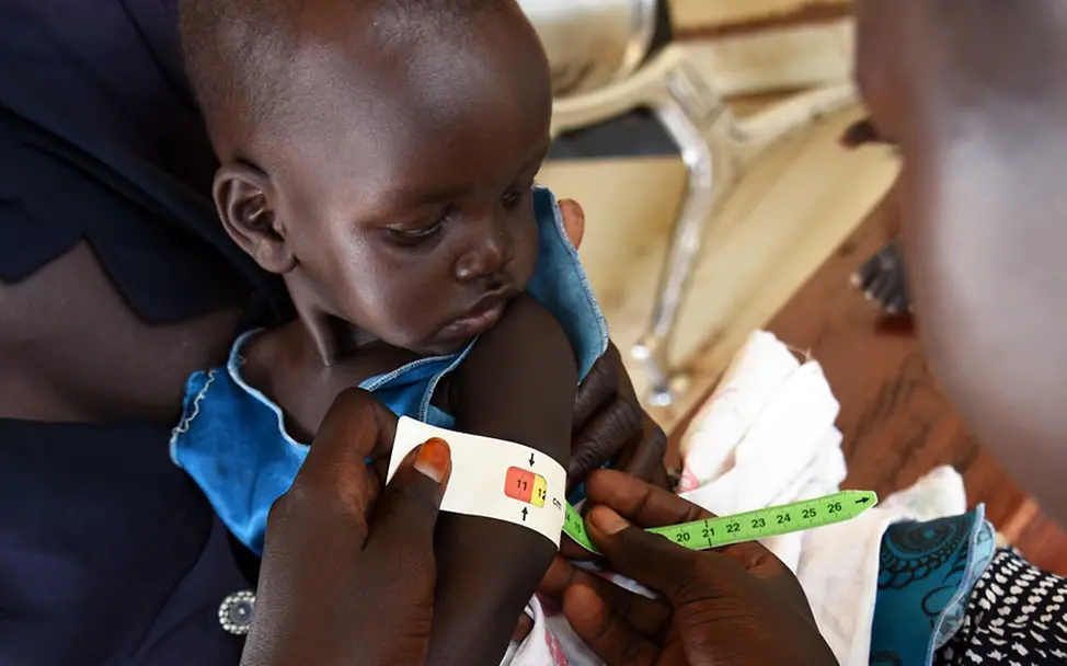 Hungersnot Afrika verhindern – Nothilfe im Südsudan: Ein Kind wird auf Mangelernährung untersucht. 
