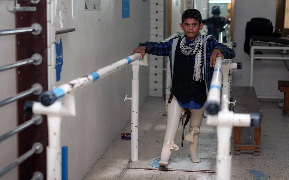 Minen im Jemen: Ibrahim hat Prothesen bekommen und übt, damit zu laufen | © UNICEF/UN0538405/Noman Minen im Jemen: Ibrahim hat Prothesen bekommen und übt, damit zu laufen