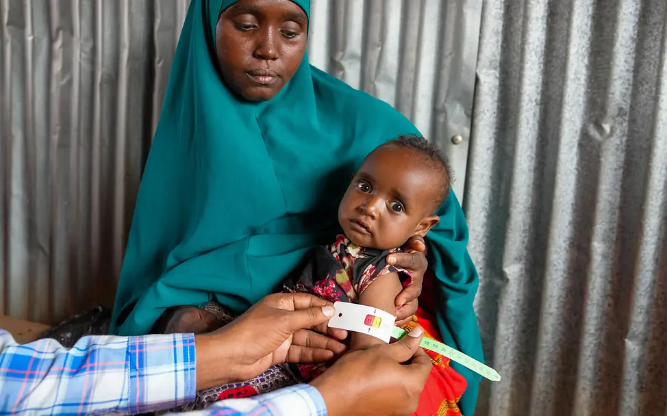 UNICEF: Ein Junge wird auf Mangelernährung untersucht.| © UNICEF/Fazel UNICEF: Ein Junge wird auf Mangelernährung untersucht.