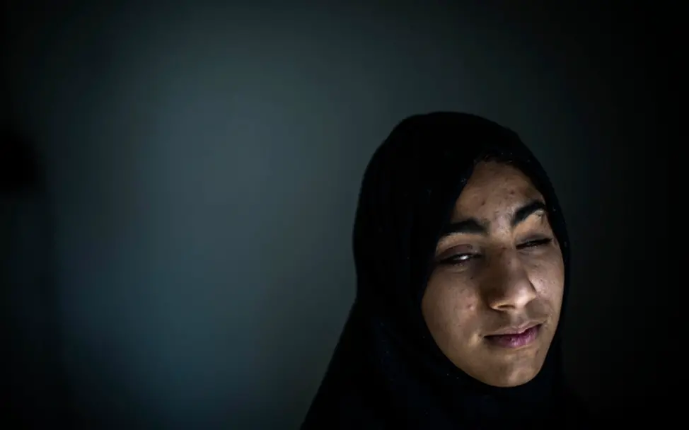 Irak: Zainab (14) wurde bei der Explosion eines Blindgängers schwer verletzt | © UNICEF/Ibarra Sánchez Irak: Zainab (14) wurde bei der Explosion eines Blindgängers schwer verletzt