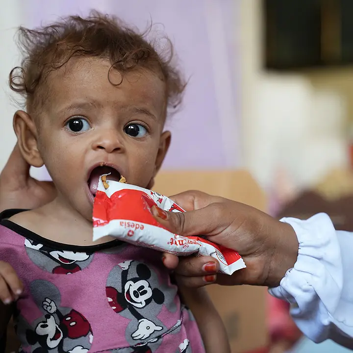 Jemen Hungersnot verhindern: Ein mangelernährtes Baby wird mit Spezialnahrung gegen den Hunger gefüttert.