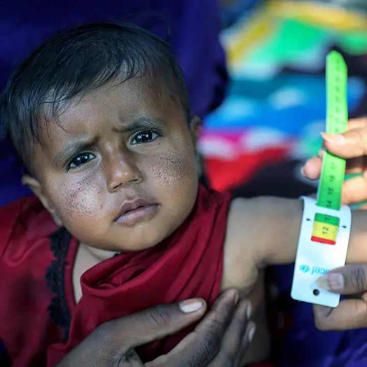 Hunger weltweit: Ein Kleinkind in Pakistan wird auf Mangelernährung getestet 