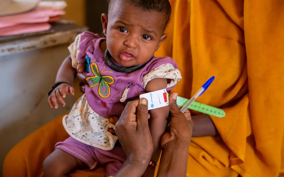 Hunger weltweit: Mangelernährte Babys und Kleinkinder brauchen unsere Hilfe, um zu überleben. 