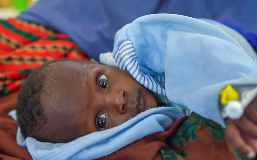 Hungersnot Afrika verhindern: Dieses Kleinkind in Somalia konnte mit Spezialnahrung gerettet werden.