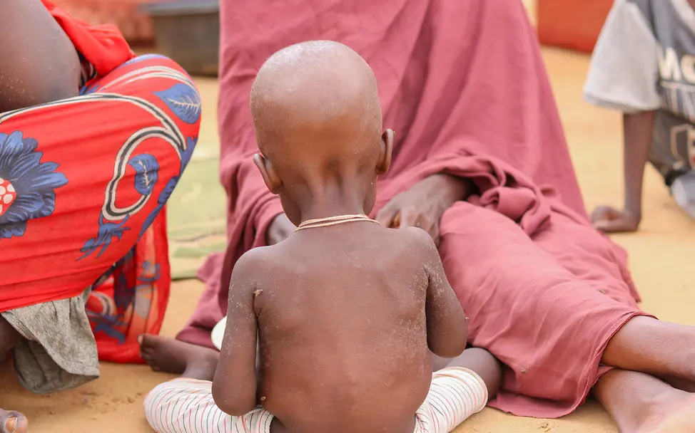 Ein stark unterernährtes Kind wird gefüttert. Hilfsgüter sind für die Menschen in Sudan extrem wichtig.