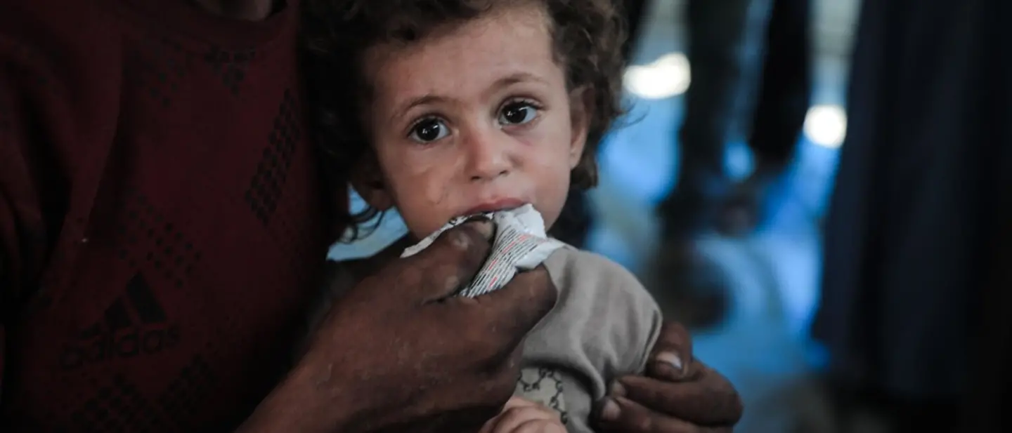 Rund 26.000 Kinder im Gazastreifen benötigen dringend eine Behandlung wegen Mangelernährung | © UNICEF/Nateel News Gaza: Rund 26.000 Kinder im Gazastreifen benötigen dringend eine Behandlung wegen Mangelernährung