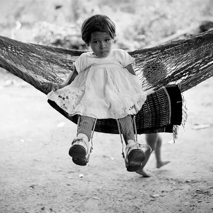 Ein an Polio erkranktes Mädchen in Mexiko mit Beinschienen auf einer Hängematte. | © UNICEF/unknown 80 Jahre UNICEF Jubiläum: Ein an Polio erkranktes Mädchen in Mexiko mit Beinschienen auf einer Hängematte.